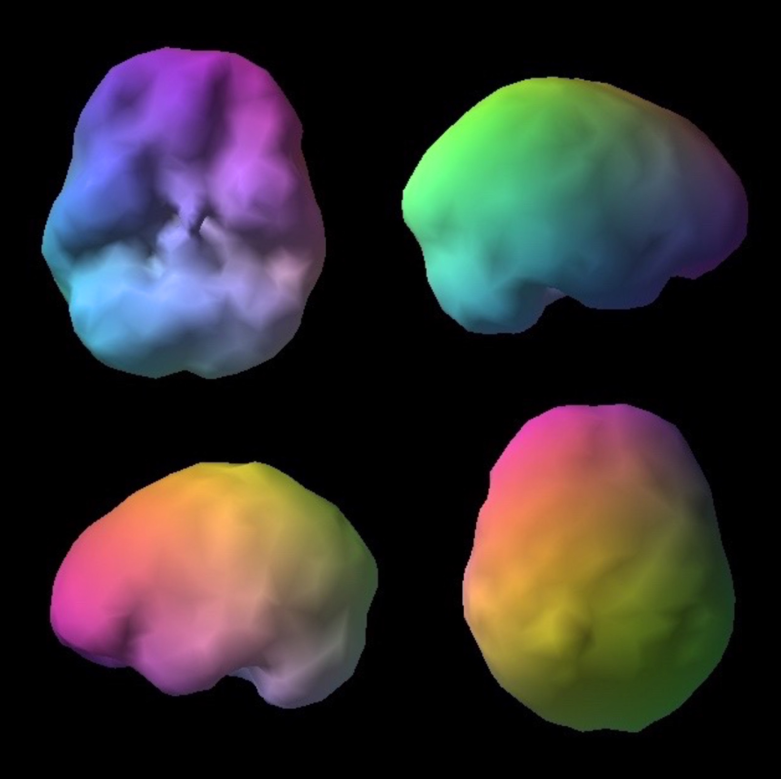Healthy brain SPECT scan